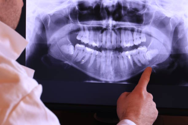 Best Emergency Treatment for Toothache in Los Alamitos, CA